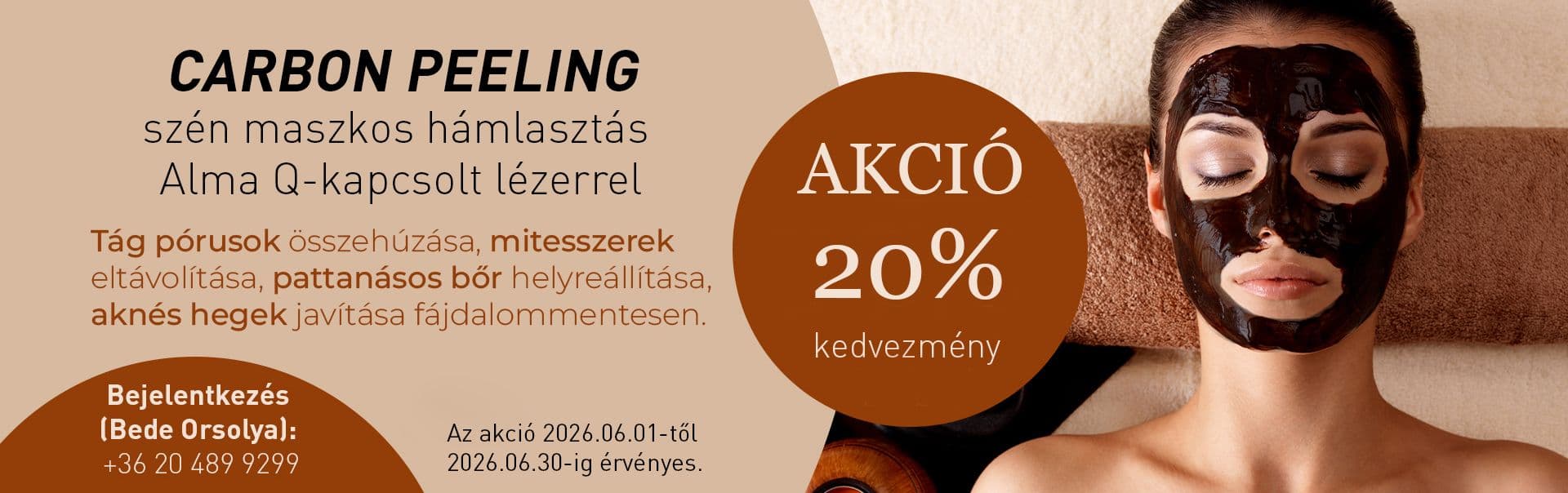 carbon_peeling_akcio_20260601.jpg