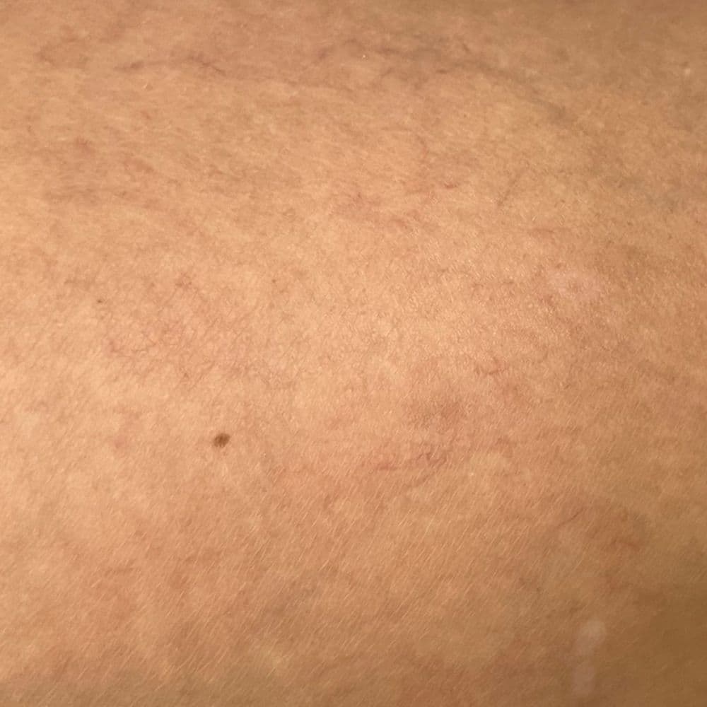 sepruvena_utana_2022.01.14_b.jpg